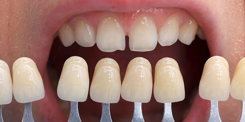 Odontologia Estetica